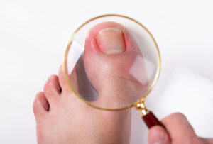 Nail Health